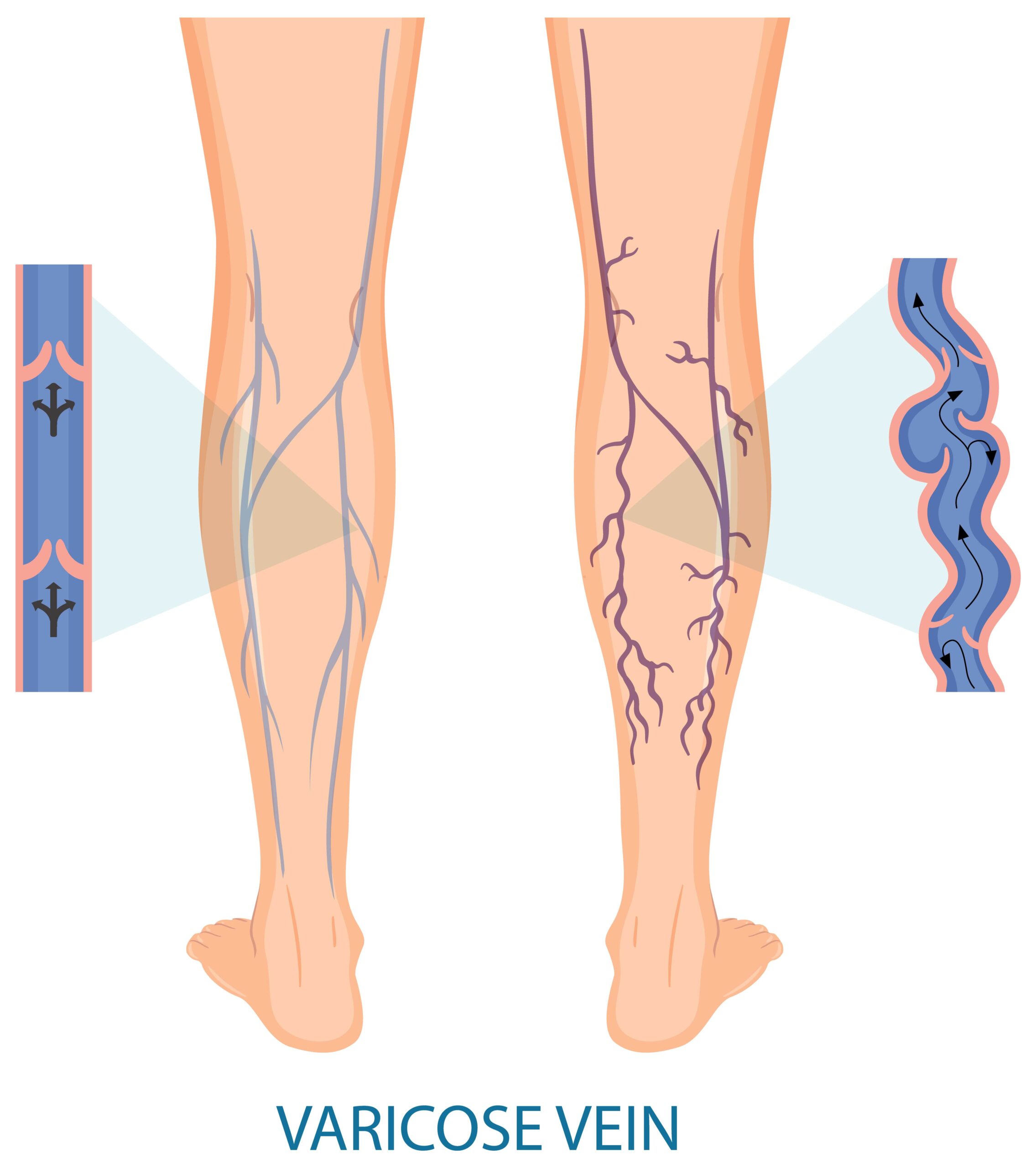 Vein Structure Diagram