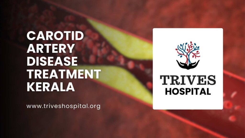 Vascular surgeon performing carotid artery stenting at TRIVES Hospital, Thrissur